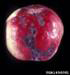 Apple Scab